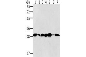Gel: 8 % SDS-PAGE,Lysate: 40 μg,Lane 1-7: Jurkat cells, Hela cells, 293T cells, 231 cells, HepG2 cells, Human normal liver tissue, Human bladder carcinoma tissue,Primary antibody: ABIN7128021(SRPRB Antibody) at dilution 1/500 dilution,Secondary antibody: Goat anti rabbit IgG at 1/8000 dilution,Exposure time: 5 seconds