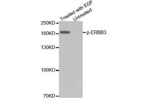 Western blot analysis of extracts from A431 cells using Phospho-ERBB3-Y1328 Antibody. (ERBB3 Antikörper  (pTyr1328))