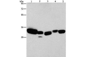 Western Blot analysis of Mouse liver and Human fetal lung tissue, hela cell and Mouse kidney tissue, Human brain malignant glioma tissue using CBR1 Polyclonal Antibody at dilution of 1:900 (CBR1 Antikörper)