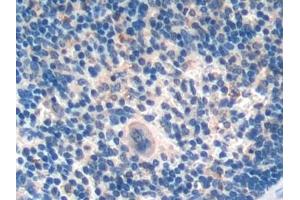 Immunohistochemistry (IHC) image for anti-Urocortin 2 (UCN2) (AA 31-112) antibody (ABIN7435025)