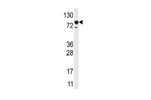 Western blot analysis of anti-EPS15 Pab in HL60 cell line lysate (35ug/lane) (EPS15 Antikörper  (C-Term))