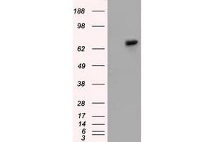 Western Blotting (WB) image for anti-Sorting Nexin 9 (SNX9) antibody (ABIN1501047) (SNX9 Antikörper)