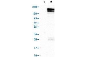 Western Blot analysis of Lane 1: negative control (vector only transfected HEK293T cell lysate) and Lane 2: over-expression lysate (co-expressed with a C-terminal myc-DDK tag in mammalian HEK293T cells) with KDM5B polyclonal antibody . (KDM5B Antikörper)