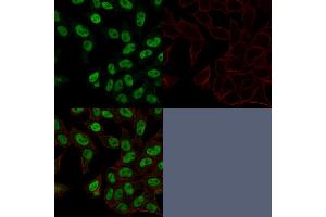 Confocal Immunofluorescence image of HeLa cells using Topo II alpha, Monoclonal Antibody (TOP2A/1362). (Topoisomerase II alpha Antikörper  (AA 1352-1493))