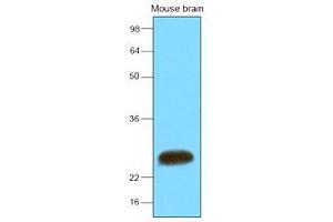 The extracts of mouse brain (30 ug) were resolved by SDS-PAGE, transferred to nitrocellulose membrane and probed with anti-human SNAP25 (1:2000). (SNAP25 Antikörper  (AA 1-206))