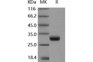 Western Blotting (WB) image for Coxsackie Virus and Adenovirus Receptor (CXADR) protein (ABIN7320433) (Coxsackie Adenovirus Receptor Protein)