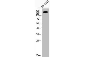 Western Blot analysis of SH-SY5Y cells using Phospho-IRS-1 (S636) Polyclonal Antibody (IRS1 Antikörper  (pSer636))