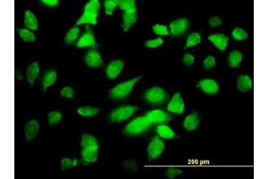 Image no. 1 for anti-conserved Helix-Loop-Helix Ubiquitous Kinase (CHUK) (AA 646-745) antibody (ABIN598611) (IKK alpha Antikörper  (AA 646-745))