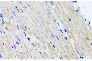 Immunohistochemistry of paraffin-embedded Mouse heart using HYAL1 Polyclonal Antibody at dilution of 1:100 (40x lens). (HYAL1 Antikörper)