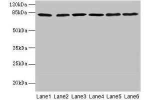Western blot All lanes: CAPN1 antibody at 6 μg/mL Lane 1: A375 whole cell lysate Lane 2: 293T whole cell lysate Lane 3: PC-3 whole cell lysate Lane 4: Jurkat whole cell lysate Lane 5: Hela whole cell lysate Lane 6: A2780 whole cell lysate Secondary Goat polyclonal to rabbit IgG at 1/10000 dilution Predicted band size: 82 kDa Observed band size: 82 kDa (CAPNL1 Antikörper  (Catalytic Subunit))