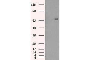 Western Blotting (WB) image for anti-Histone Deacetylase 10 (HDAC10) antibody (ABIN1498615) (HDAC10 Antikörper)