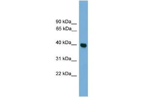 WB Suggested Anti-GNAI3 Antibody Titration: 0. (GNAI3 Antikörper  (Middle Region))