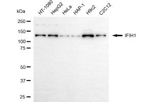 Western blotting analysis using IFIH1 antibody (ABIN7799084).
