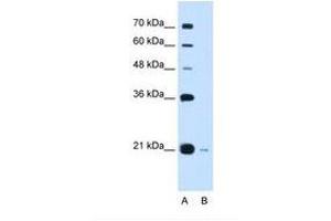 Image no. 2 for anti-DCTP Pyrophosphatase 1 (DCTPP1) (C-Term) antibody (ABIN6738241) (DCTPP1 Antikörper  (C-Term))