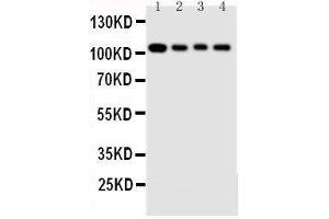 Anti-Hsp105 antibody, Western blotting Lane 1: Rat Ovary Tissue Lysate Lane 2: A549 Cell Lysate Lane 3: U87 Cell Lysate Lane 4: HELA Cell Lysate (HSPH1 Antikörper  (C-Term))
