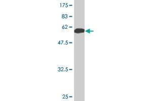 Western Blot detection against Immunogen (53. (14-3-3 sigma/SFN Antikörper  (AA 1-248))