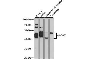 Western blot analysis of extracts of various cell lines, using ADAP1 antibody. (ADAP1 Antikörper)