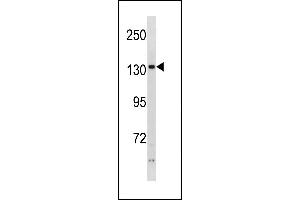 PHKA2 Antibody (N-term) (ABIN1881651 and ABIN2843259) western blot analysis in ZR-75-1 cell line lysates (35 μg/lane). (PHKA2 Antikörper  (N-Term))