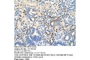 Human kidney (ZNF326 Antikörper  (C-Term))