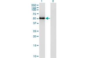 Western Blot analysis of FLI1 expression in transfected 293T cell line by FLI1 monoclonal antibody (M02), clone 2G8. (FLI1 Antikörper  (AA 1-452))