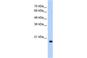 Western Blotting (WB) image for anti-DCTP Pyrophosphatase 1 (DCTPP1) antibody (ABIN2462971) (DCTPP1 Antikörper)