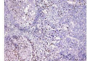 IHC analysis of IGLL1 using anti-IGLL1 antibody (ABIN6719329).