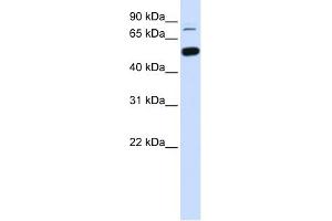 Western Blotting (WB) image for anti-SWI/SNF Related, Matrix Associated, Actin Dependent Regulator of Chromatin, Subfamily D, Member 1 (SMARCD1) (Middle Region) antibody (ABIN2787638)