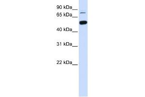 WB Suggested Anti-SMARCD1 Antibody Titration: 0. (SMARCD1 Antikörper  (Middle Region))