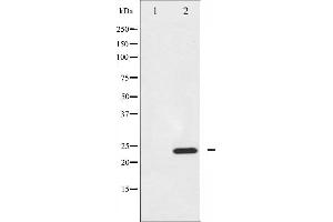 Western blot analysis of BIK expression in A549 whole cell lysates,The lane on the left is treated with the antigen-specific peptide.