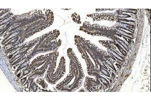 IHC analysis of YTHDF2 using anti-YTHDF2 antibody (ABIN7603191). (YTHDF2 Antikörper  (N-Term))
