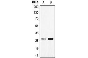 Western blot analysis of CD70 expression in Jurkat (A), NCIH460 (B) whole cell lysates. (CD70 Antikörper  (Center))