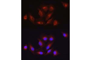 Immunofluorescence analysis of U2OS cells using  Rabbit pAb (ABIN3020671, ABIN3020672, ABIN1512605 and ABIN6213659) at dilution of 1:100 (40x lens). (ATF6 Antikörper  (AA 1-190))