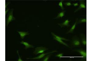 Immunofluorescence of purified MaxPab antibody to PPP2R4 on HeLa cell.