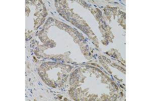 Immunohistochemistry of paraffin-embedded human prostate using VIP antibody (ABIN6292338) (40x lens). (Vip Antikörper)