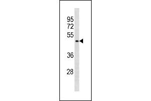 BCL6B Antibody (Center) (ABIN1881109 and ABIN2843280) western blot analysis in A549 cell line lysates (35 μg/lane). (BCL6B Antikörper  (AA 276-302))