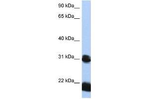 WB Suggested Anti-OTX1 Antibody Titration:  0. (OTX1 Antikörper  (N-Term))