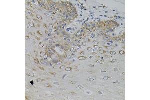 Immunohistochemistry of paraffin-embedded human esophagus using IRF1 antibody (ABIN5995375) (40x lens). (IRF1 Antikörper)