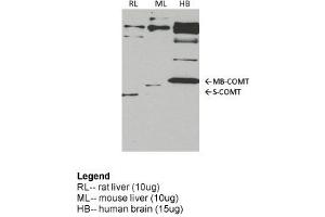 COMT antibody - middle region  validated by WB using rat liver, mouse lung, human brain at 1:1000. (COMT Antikörper  (Middle Region))