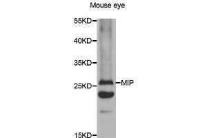 Western blot analysis of extracts of mouse eyes tissue lysate, using MIP antibody. (MIP Antikörper)