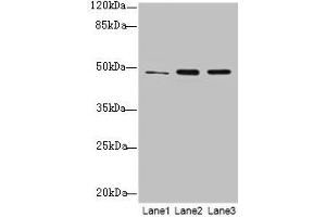 Western blot All lanes: GPR83 antibody at 2 μg/mL Lane 1: HCT116 whole cell lysate Lane 2: U87 whole cell lysate Lane 3: MCF-7 whole cell lysate Secondary Goat polyclonal to rabbit IgG at 1/10000 dilution Predicted band size: 49 kDa Observed band size: 49 kDa (GPR83 Antikörper  (AA 349-423))