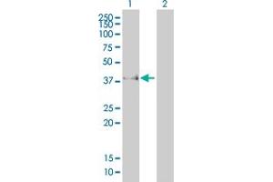 Western Blotting (WB) image for anti-Fc Fragment of IgG, Low Affinity IIb, Receptor (CD32) (FCGR2B) (AA 45-154) antibody (ABIN560858)