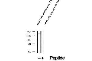 Western blot analysis of extracts of MCF7 cells treated with TPA, using Phospho-BCL9L (Ser915) Antibody.