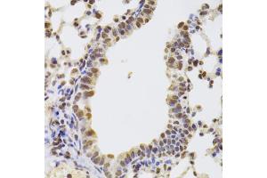 Immunohistochemistry of paraffin-embedded mouse lung using AAAS Antibody. (Adracalin Antikörper)