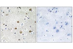 Immunohistochemistry analysis of paraffin-embedded human brain tissue using TF3B antibody. (BRF1 Antikörper  (Internal Region))