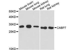 Western blot analysis of extracts of various cell lines, using CABP7 antibody. (CABP7 Antikörper)