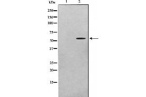 Western blot analysis on A549 cell lysate using ADCK1 Antibody,The lane on the left is treated with the antigen-specific peptide. (ADCK1 Antikörper  (Internal Region))