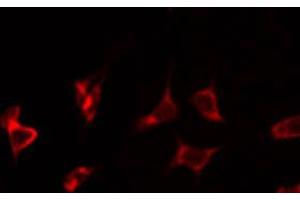 ABIN6266823 staining HeLa by IF/ICC. (TUSC2 Antikörper  (Internal Region))