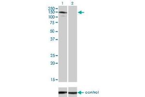 Western blot analysis of ABL2 over-expressed 293 cell line, cotransfected with ABL2 Validated Chimera RNAi (Lane 2) or non-transfected control (Lane 1).