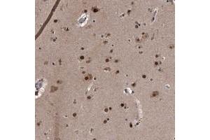 Immunohistochemical staining of human cerebral cortex with ZNF518B polyclonal antibody  shows strong nuclear positivity in neuronal and glial cells. (Zinc Finger Protein 518B (ZNF518B) Antikörper)