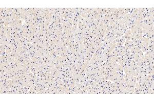 Detection of LDHA in Human Cardiac Muscle Tissue using Polyclonal Antibody to Lactate Dehydrogenase A (LDHA) (Lactate Dehydrogenase A Antikörper  (AA 1-332))